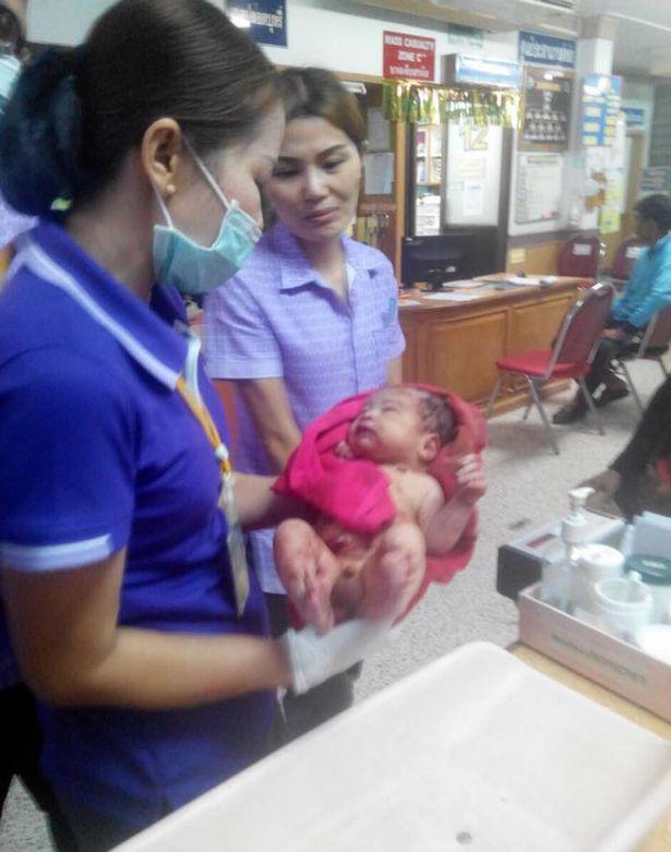 婴儿被捅14刀后又遭活埋 竟奇迹生还