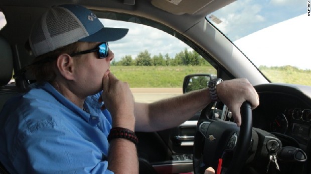 世界首例换脸手术患者病逝：我在镜中看到了自己