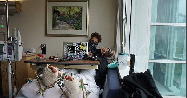 美网红表演跳水 跳到水泥地上双脚粉碎性骨折