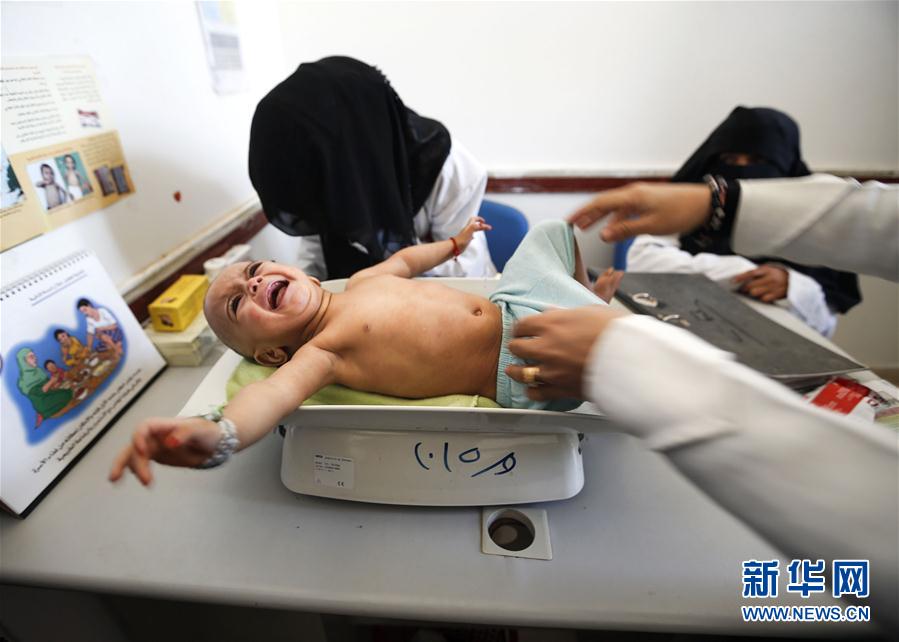 （外代一线）（1）也门：将近220万儿童营养不良