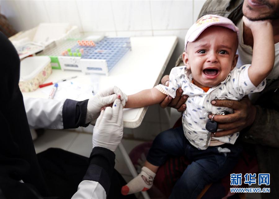 （外代一线）（3）也门：将近220万儿童营养不良