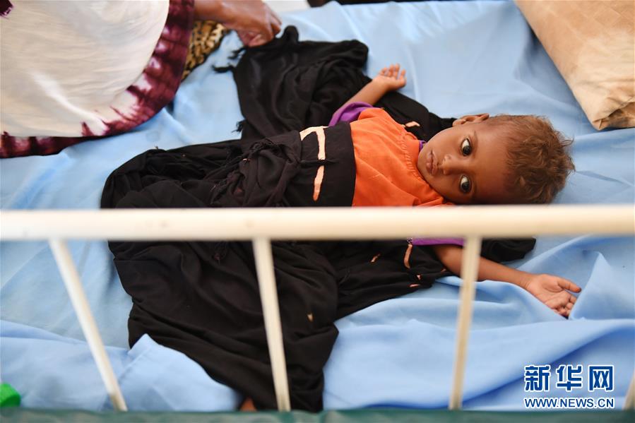 （国际）（8）旱灾导致患严重急性营养不良的索马里儿童大幅增加