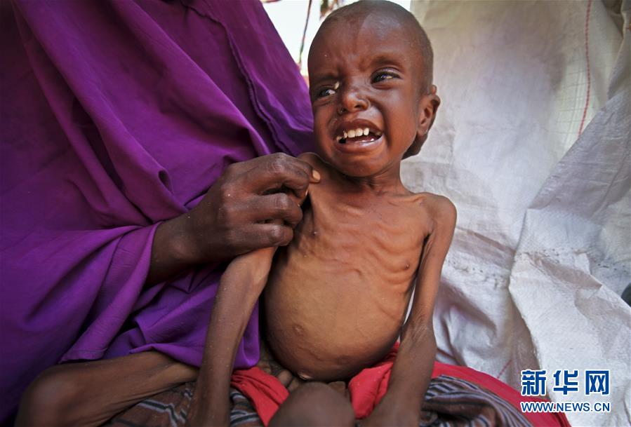 （外代一线）（7）索马里遭遇严重旱灾