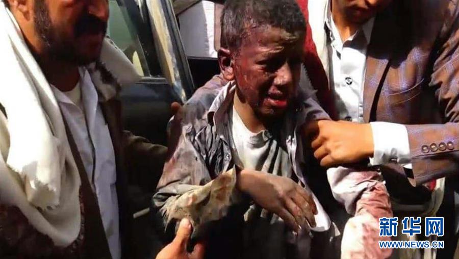 （国际&middot;一周看天下）遭遇空袭的孩子