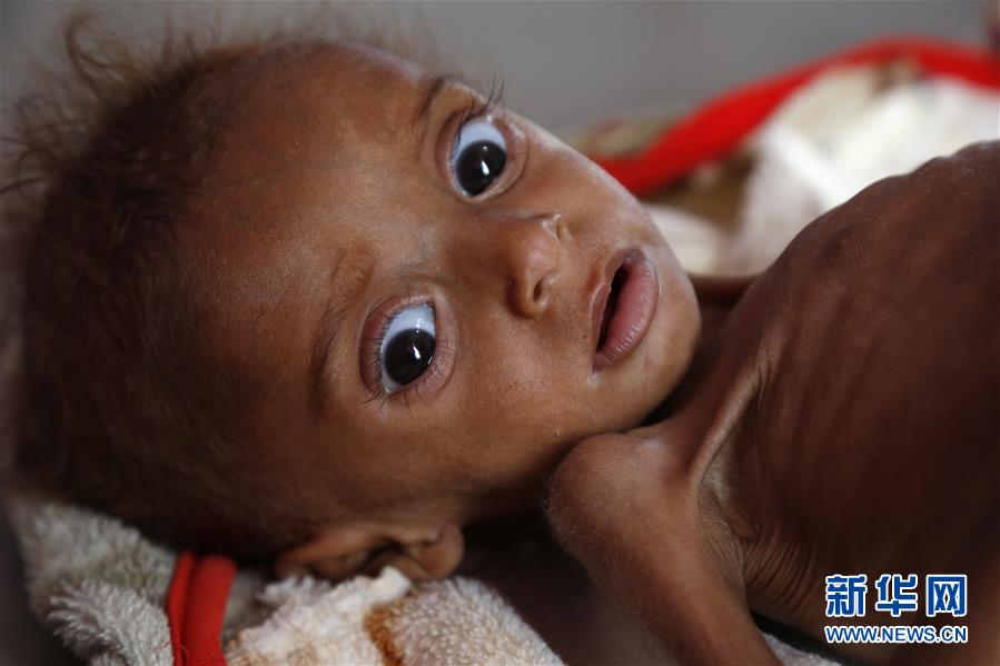 （国际）（2）国际消除贫困日：关注贫困