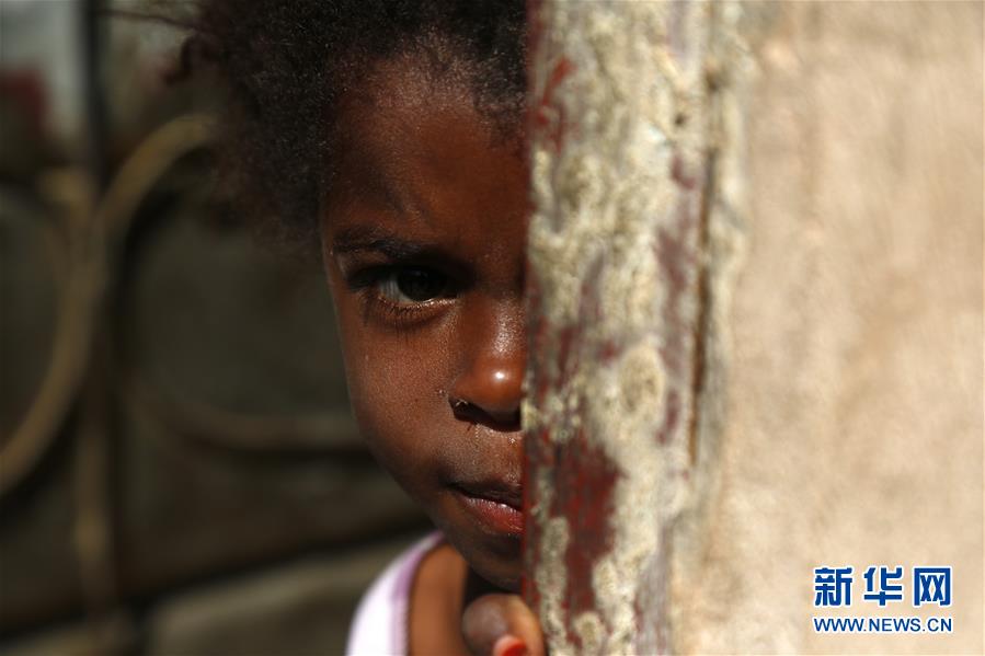 （国际）（4）也门开展小儿麻痹症免疫活动 