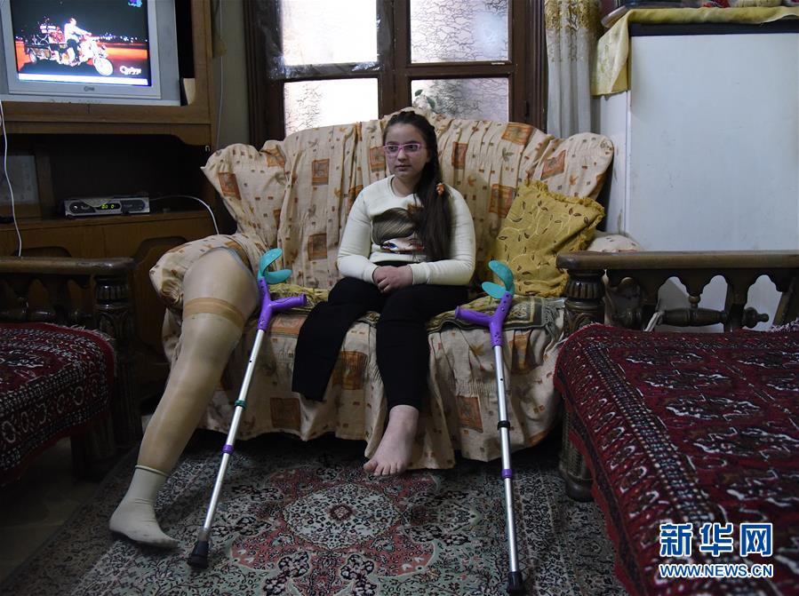 (国际·图文互动)(1)通讯:战争给他们留下残缺的童年——叙利亚危机9周年记