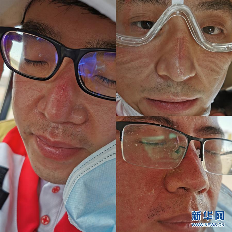 （国际疫情&middot;图文互动）（5）通讯：中国专家组助伊拉克解病例筛查&ldquo;燃眉之急&rdquo;