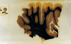 英國“人腦”展 愛因斯坦的大腦切片展出(圖)