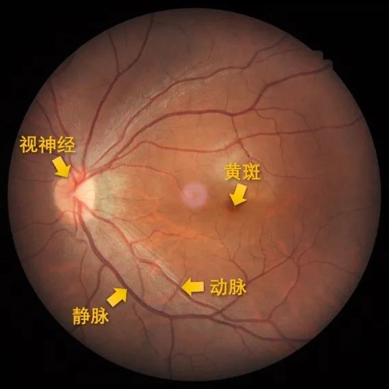 协和星原计划眼底一张照眼病早知道