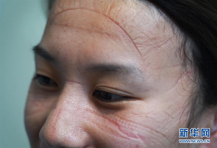 这是南昌大学第一附属医院象湖院区隔离病房重症监护室值班护士程姝菡