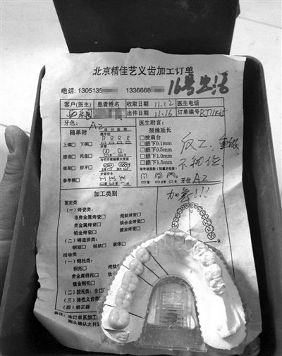 精佳艺义齿加工订单显示&ldquo;反（返）工、重做&rdquo;等字样，一名骨干业务员说，该厂产品返工率占两成。