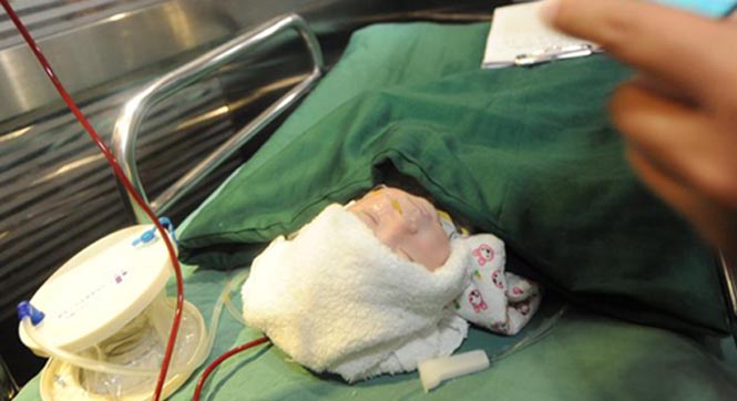 山西&ldquo;无肛男婴&rdquo;造瘘手术成功