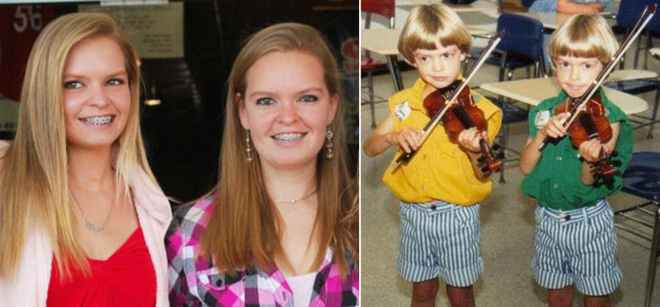 全球最不可思议的双胞胎(组图)