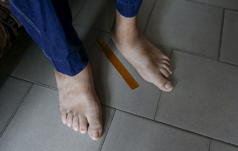 委内瑞拉男子拥有40厘米大脚 打破世界纪录(组图)