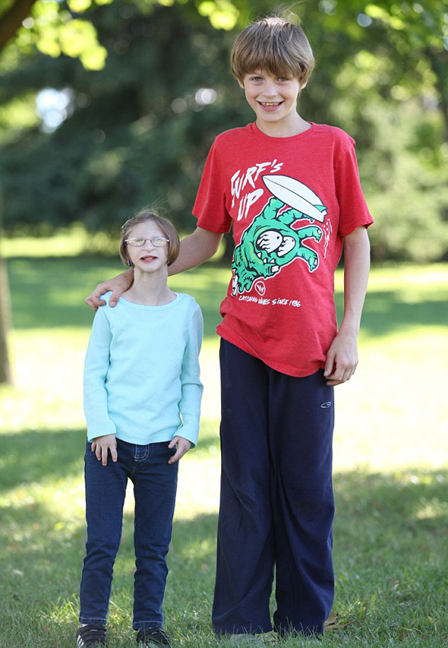 加拿大12岁拇指姑娘体重如同2岁婴儿高清组图