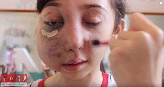 英国11岁面部畸形少女成网红 获百万网友支持(组图)