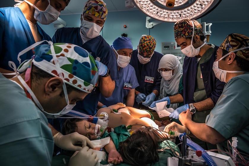 重获新生巴基斯坦连体婴儿成功分离组图