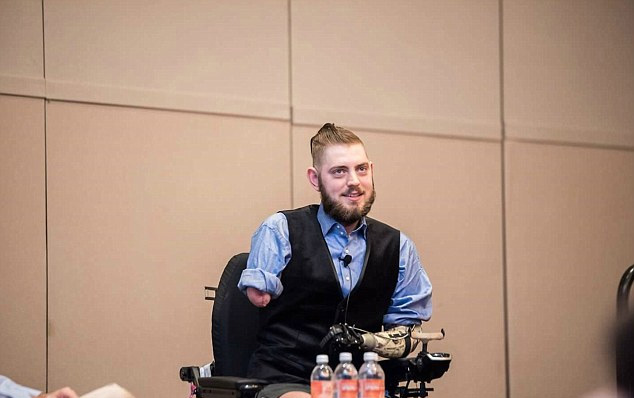 美残疾退伍士兵重获双臂手指可自如活动组图